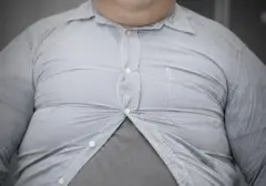 Pria Malaysia 190 Kg Derita Gagal Ginjal Akut Akibat Pola Makan Jauh dari Sehat