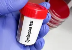 Wabah Cyclosporiasis Melanda AS, Diduga Terkait Konsumsi Sayuran Tercemar