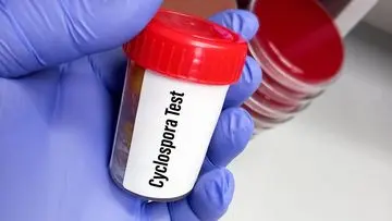 Wabah Cyclosporiasis Melanda AS, Diduga Terkait Konsumsi Sayuran Tercemar