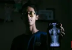 Titanium, Sahabat Seumur Hidup dalam Perjuangan Melawan Skoliosis