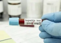 Hepatitis 'Pembunuh Senyap': Mengapa Deteksi Dini Menjadi Tantangan Besar
