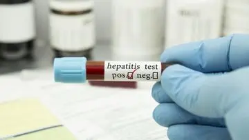Hepatitis 'Pembunuh Senyap': Mengapa Deteksi Dini Menjadi Tantangan Besar