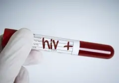 Kemenkes Klarifikasi Isu Viral Ratusan Anak Sidoarjo Terpapar HIV, Ungkap Data Kasus Nasional
