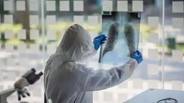 Polusi Udara Mengintai, Dua Penyakit Ini Jadi Ancaman Serius Warga