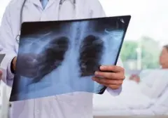 Kabut Asap Karhutla Picu Lonjakan Kasus Pneumonia di Pontianak