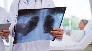 Kabut Asap Karhutla Picu Lonjakan Kasus Pneumonia di Pontianak