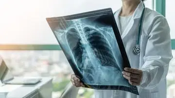 Studi Terbaru Ungkap Kadar Mikroplastik Tinggi pada Pasien Kanker Paru-paru, Kaitan dengan Polusi Dipertanyakan