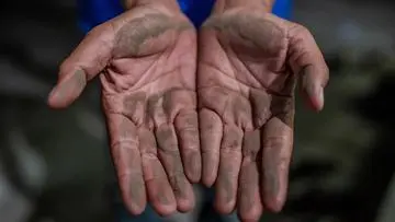 Lindungi Kulit dari Abu Vulkanik: Panduan Penanganan Iritasi Pasca-Letusan Gunung Api
