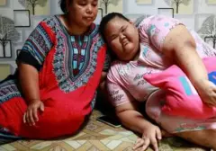 Remaja Bogor Terpaksa Berhenti Sekolah Akibat Perundungan Karena Obesitas