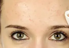 Abu Vulkanik Mengancam Kulit? Tips Aman Bersihkan Makeup Pasca Erupsi Gunung