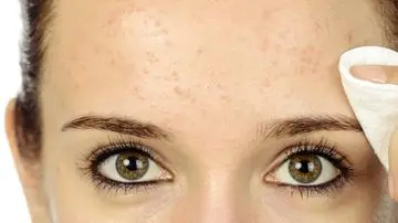 Abu Vulkanik Mengancam Kulit? Tips Aman Bersihkan Makeup Pasca Erupsi Gunung